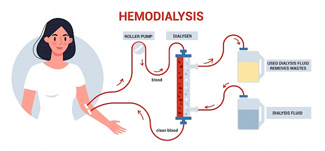 hamodialyse-pumpen1